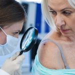 Skin Cancer Awareness: Squamous Cell Carcinoma