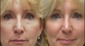 Should You See a Doctor About Wrinkles or Sagging Skin?