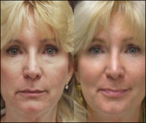 Should You See a Doctor About Wrinkles or Sagging Skin?