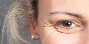 How Long Does It Take for Botox to Take Effect?