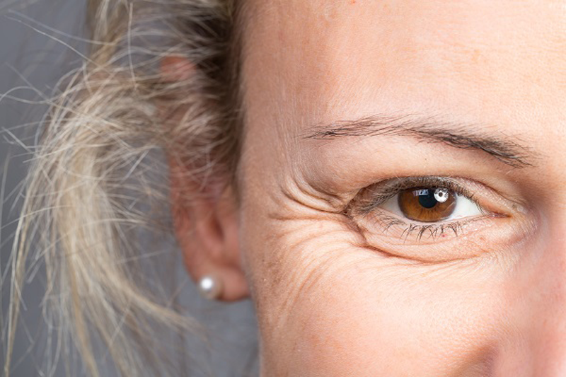 How Long Does It Take for Botox to Take Effect?
