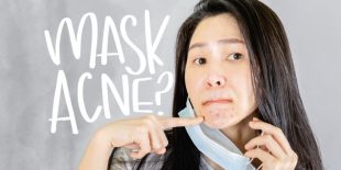 How to Prevent Acne from Mask Use